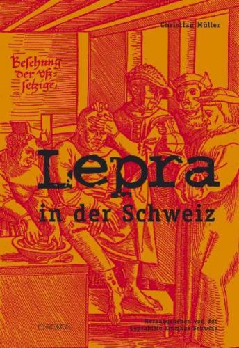 Lepra in der Schweiz 